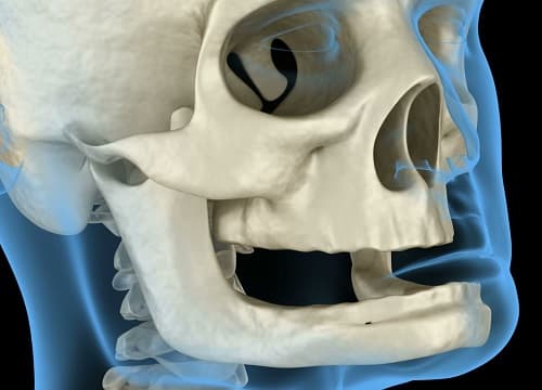 Corrective & Orthognathic Jaw Surgery Costs