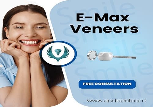 Emax Veneers Turkey Price